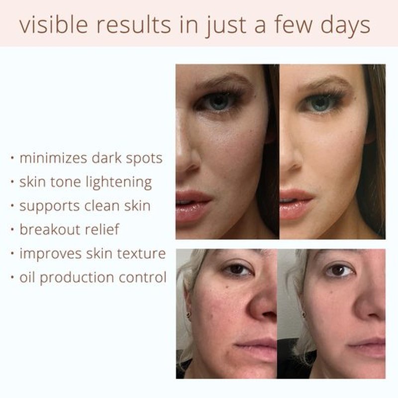 Coffeeface Anti-Aging Moisture Pads - 3-in-1 Exfoliating & Hydrating Treatment | Hypoallergenic | 8 Count