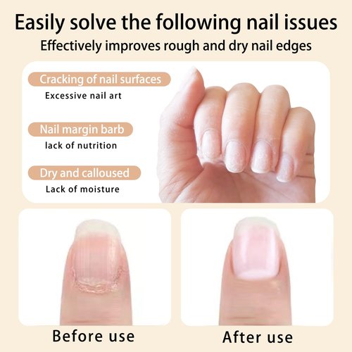SULLMAR 12pcs Cuticle Oil Pen Sweet Almond Nail Growth Serum and Repair Treatment Hydrating Oil for Dry Cuticles and Skin Cuticle Buddy Revitalize Nails with Radiant Cosmetics' Nail Growth Oil