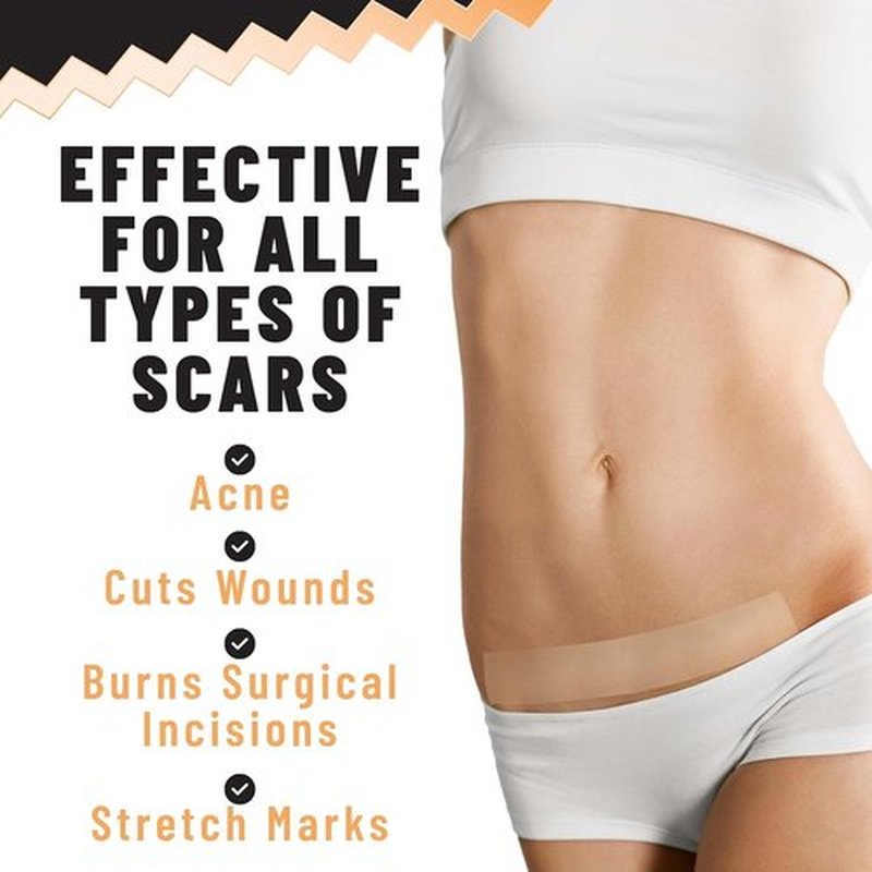 TOLEVITA Silicone Scar Patches – Silicone Gel Sheets for Scars, Acne, Surgery, Keloid, Scar Removal and Stretch Marks – Gentle Scar Care & Fading - 5 Sheets