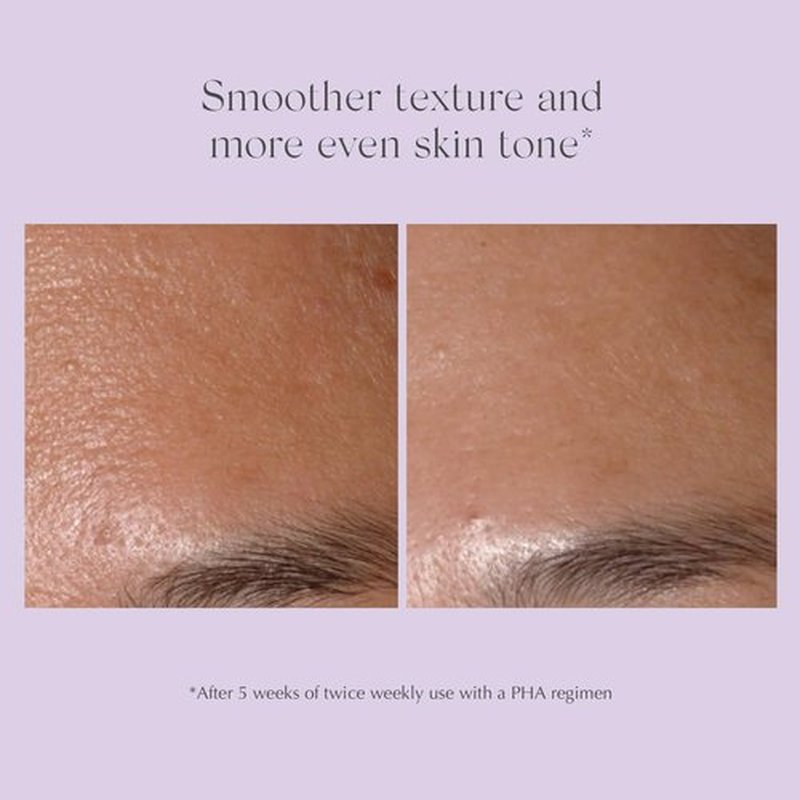 Exuviance Performance Peel AP25 - At-Home Chemical Peel with Glycolic Acid | Anti-Aging Treatment for Fine Lines & Uneven Texture