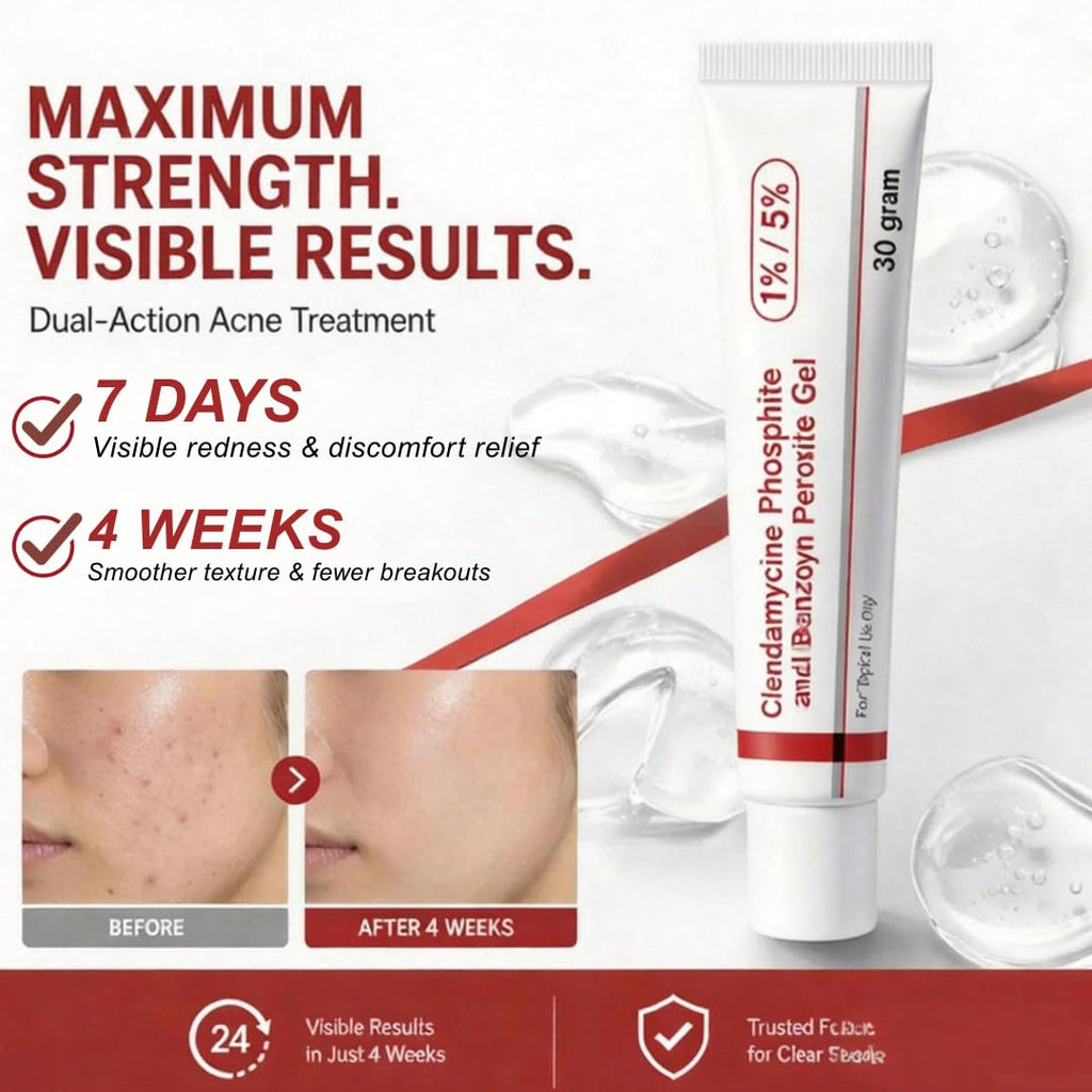 Oricanto Benzoyn Peroxite Acne Spot Treatment Gel, Acne-Clearing, Pimple Gel Calms Visible Redness, Facial Moisturizer, For All Skin Types, 1 oz