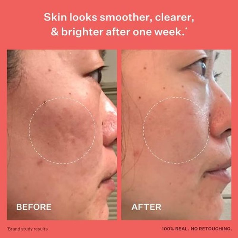 Peach & Lily - Glass Skin Refining Serum for Face | Hyaluronic Acid & Niacinamide, 1.35 oz - Vegan, Cruelty-Free
