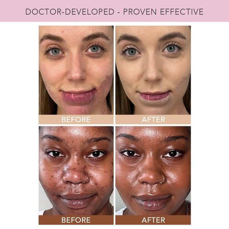Doll 10 TCE Liquid Filter – CC Cream Foundation - Liquid Foundation - Lightweight Tinted Moisturizer & Skin Tint - Blurs Pores & Fine Lines - Vegan - Clean Makeup - [Light] - 30 Day Supply