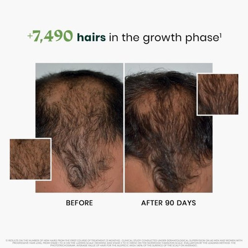 Rene Furterer Triphasic Serum for Hormonal Thinning Hair | Drug-Free, Leave-In Treatment - 30-Day Supply