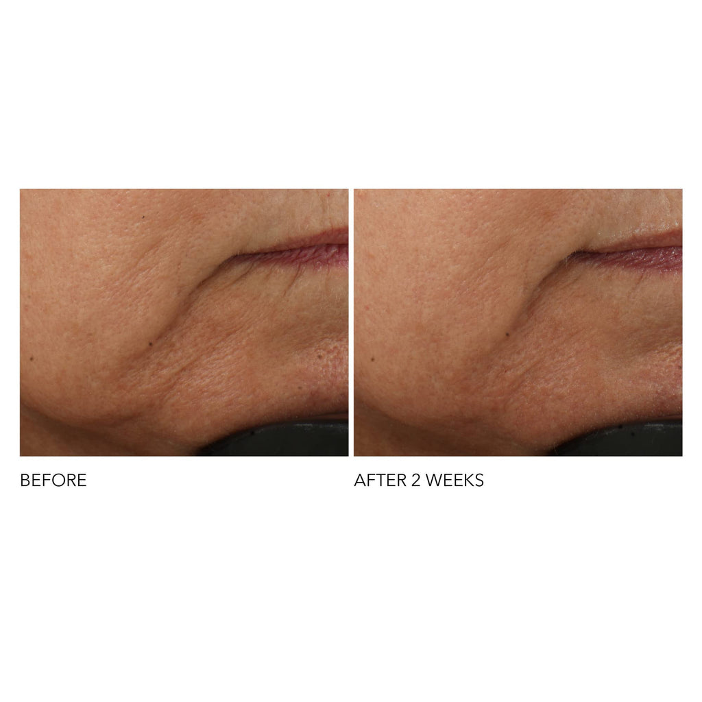 Dr Dennis Gross Advanced Retinol and Ferulic Intense Wrinkle Cream, White, 2 Ounce (Pack of 1)