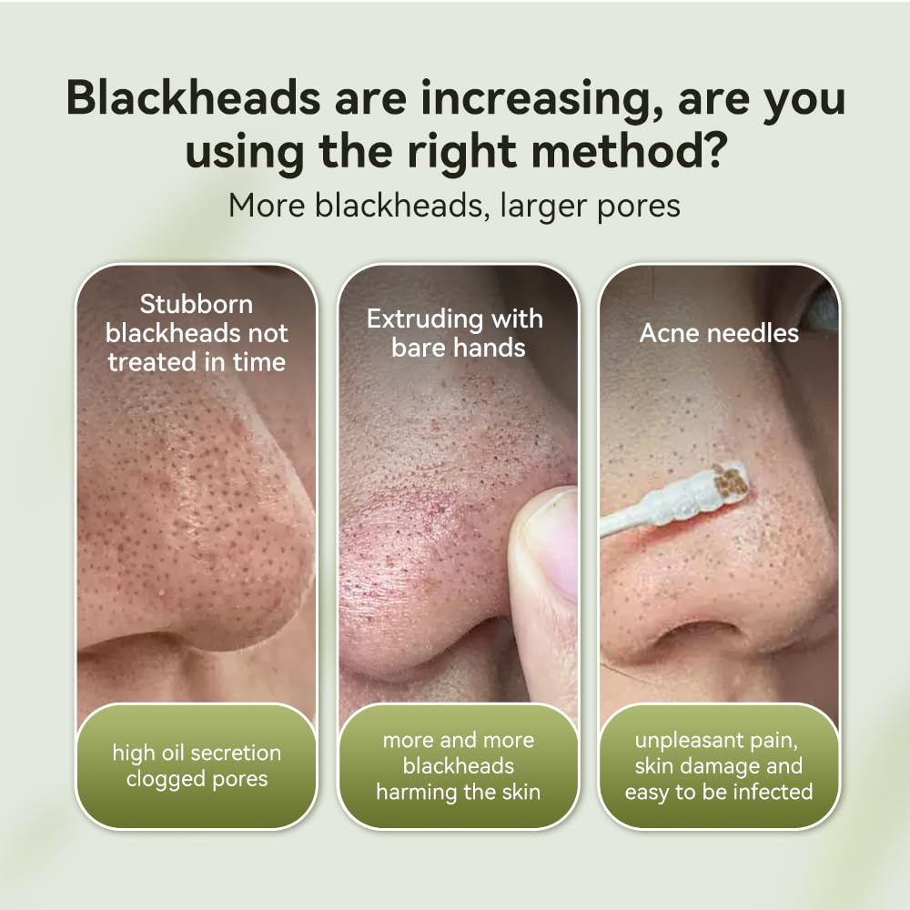LANBENA Blackhead Mask, Nose Plants Pores Strips Blackhead Remover Mask Peel off Mask Facial Pore Cleanser Purifying Face Mask Nose Strips (1.06 Ounce) - White