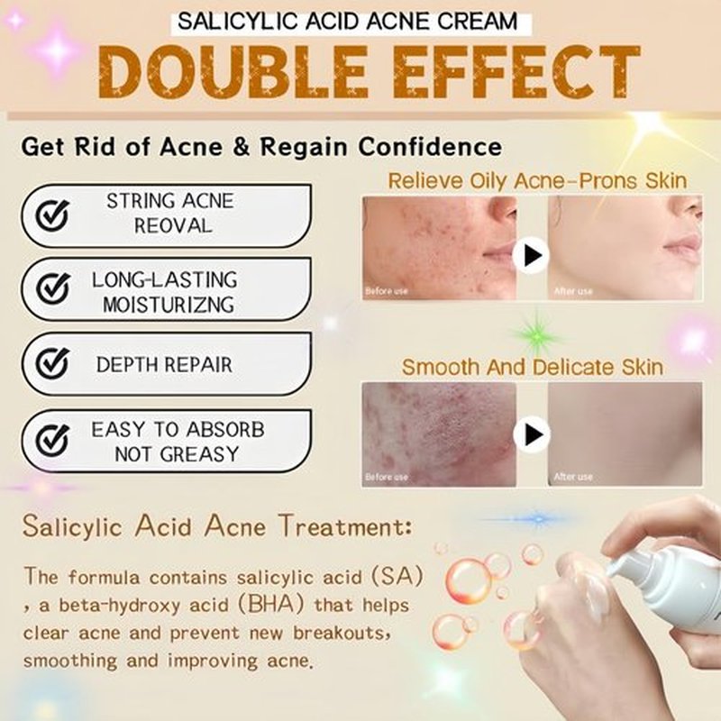 Skiennix Salicylic Acid Acne Treatment Face Cream - Oil Control & Pore Refining, Non-Comedogenic, 50ml / 1.69oz (2)