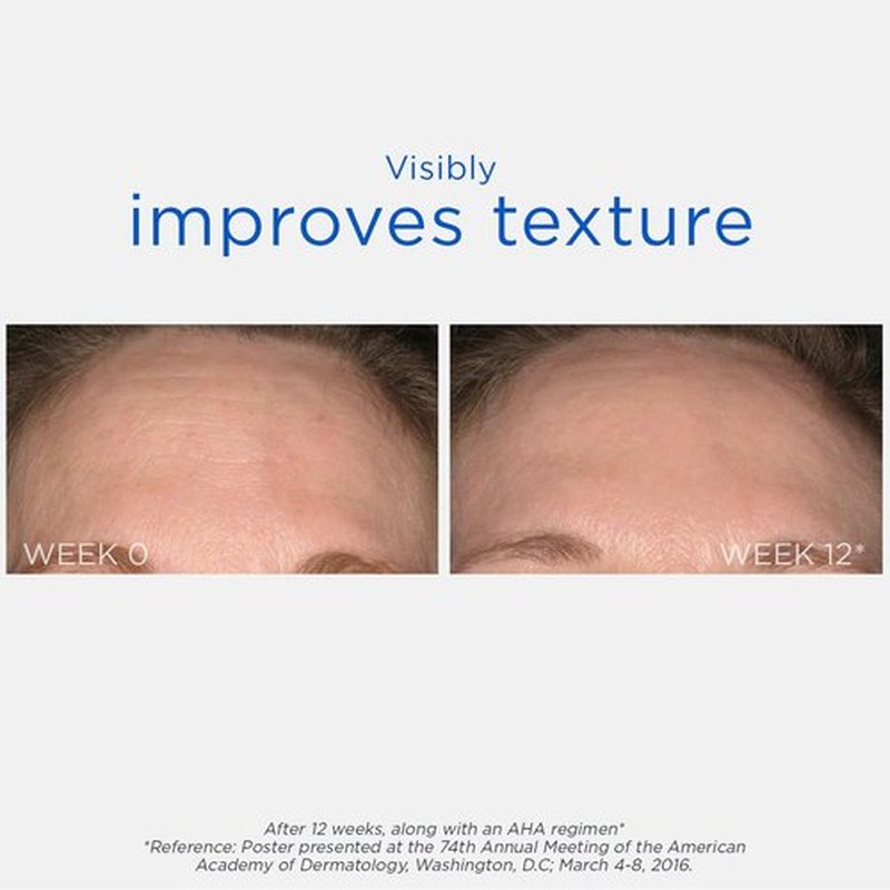 NEOSTRATA Smooth Surface Glycolic Peel - High-Strength Exfoliating Treatment, 2 Fl. Oz.