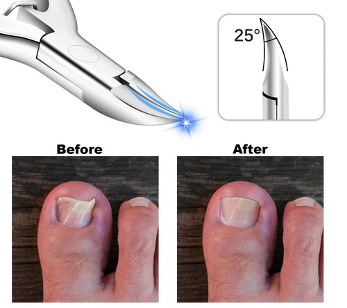Moosec Toenail Clippers for Ingrown and Thick Toenails with Safety Lock Comfortble Wooden Handle Sturdy Toenail Clippers