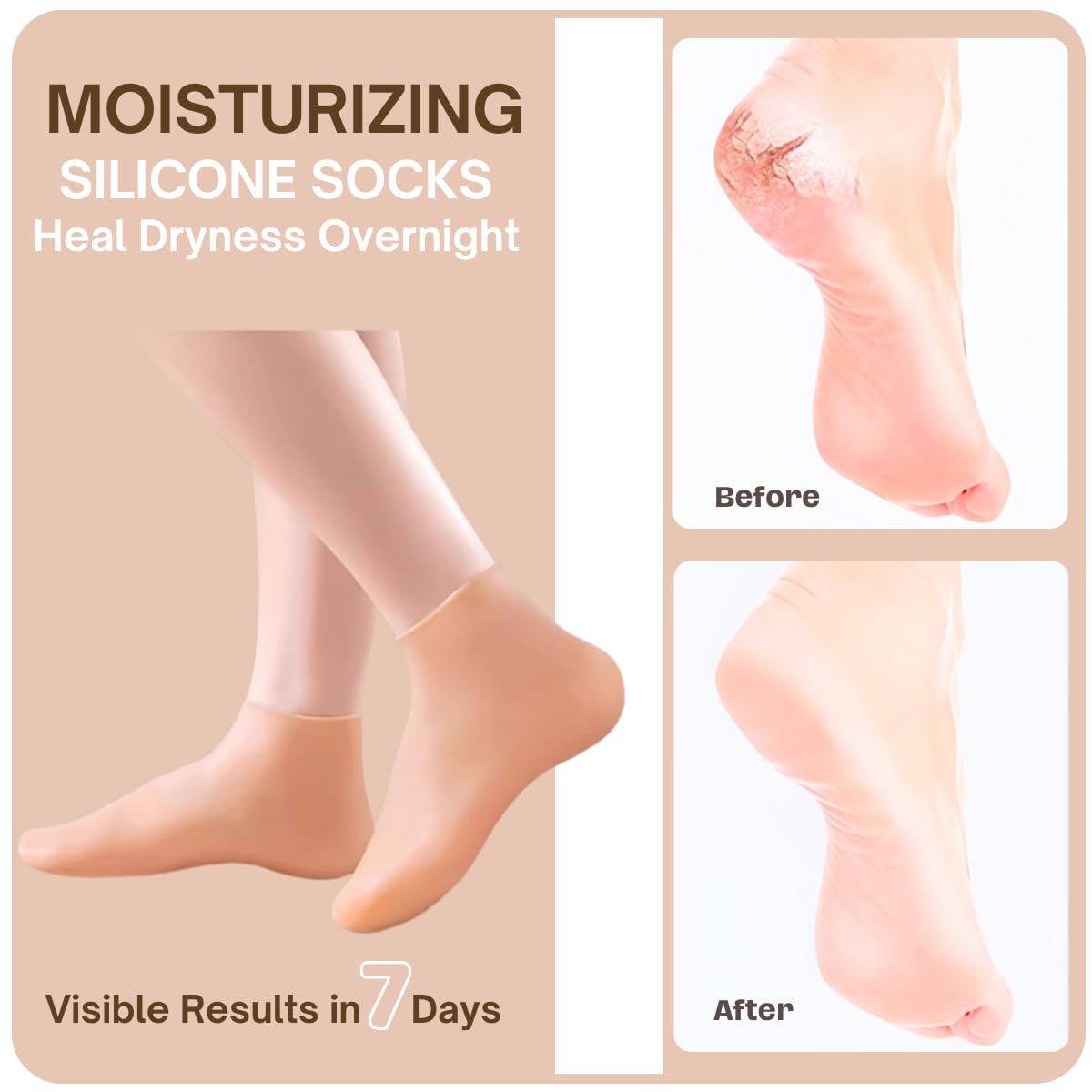 Yoeeco Reusable Silicone Socks for Dry Cracked Feet & Heels - Moisturizing Socks for Women and Men Fits Sizes US5-12 - Lotion Rubber Socks for Overnight Repair & Spa Treatment (Beige & Pink)