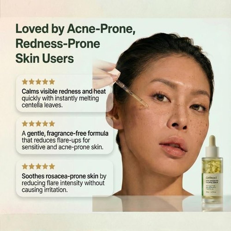 Centella | Soothing Serum with 494,700 ppm Centella Asiatica - Acne Relief for Sensitive Skin, 30ml