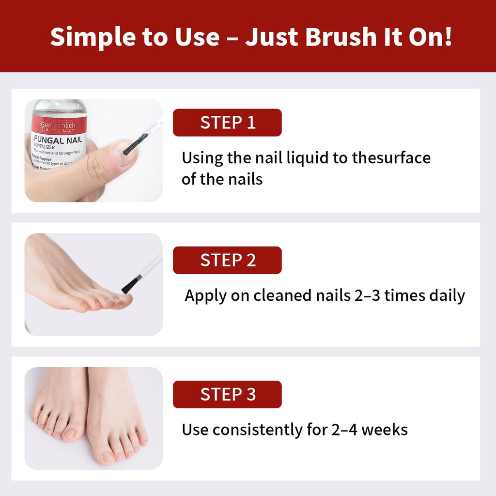 Toenail Fungus Treatment Extra Strength, Nail Fungus Treatment with Undecylenic Acid for Toenail & Fingernails, Antifungal Nail Repair for Athletes Foot, Ingrown, Thick, Broken, Damaged Nail, 30ml