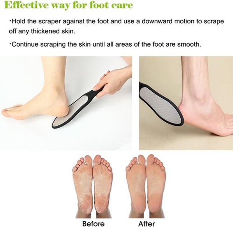 BEZOX Foot File - Double-Sided Callus Remover for Cracked Heels | Stainless Steel with Storage Bag