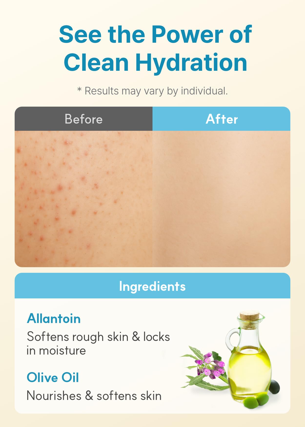Derma B | Daily Moisture Body Lotion | Body Cream for Dry Skin | Long-Lasting Body Moisturizer for Sensitive Skin | 13.5 fl oz (400ml)