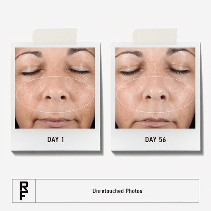 Rodan + Fields Active Hydration Serum - Boosts Hydration Levels with Glycerin & Hyaluronic Acid | 1oz