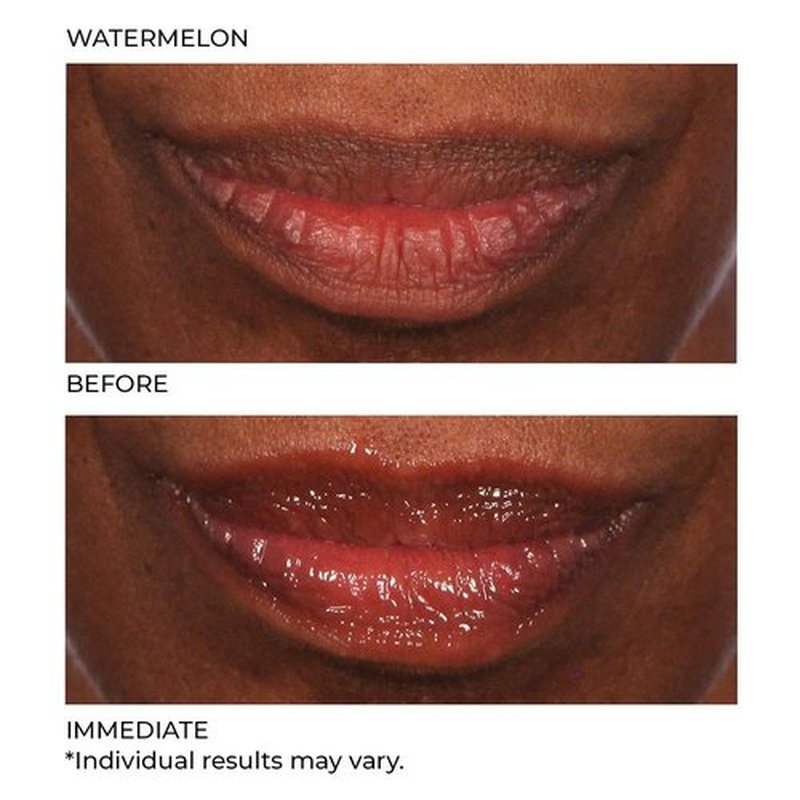 NassifMD Hydro-Screen Lip Plumping Oil - Hydrating Serum with Hyaluronic Acid & Ceramide Jojoba Gloss