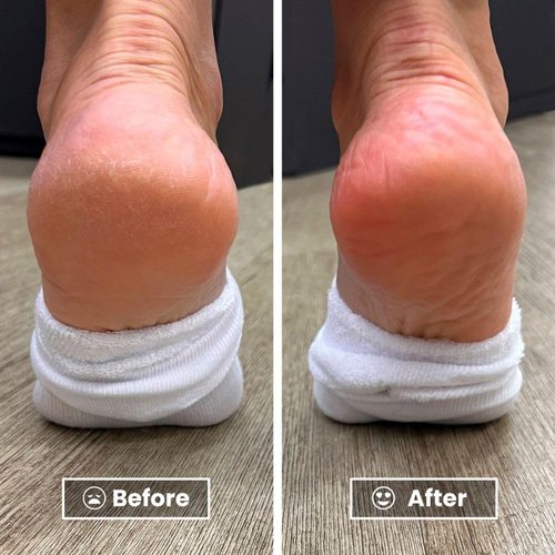 LONDONTOWN Pedikur Foot Balm Restorative Smoother Soles & Softer Heels, Vegan & Cruelty Free, 1 fl oz