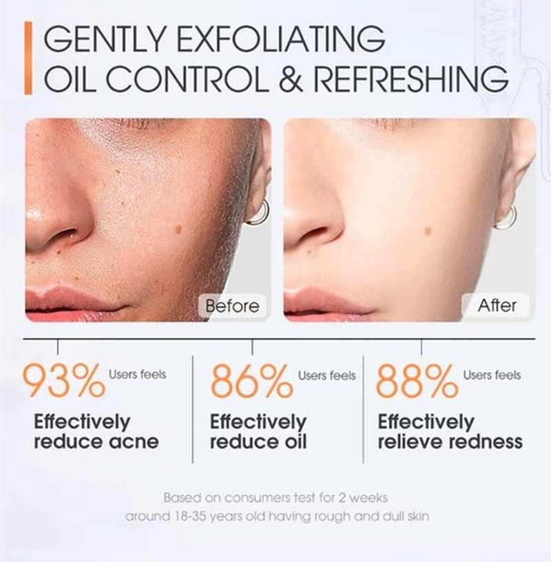 SKINEVER Salicylic Acid Face Exfoliating Scrub - Deep Cleansing for Smooth, Moisturized Skin (75 ML)
