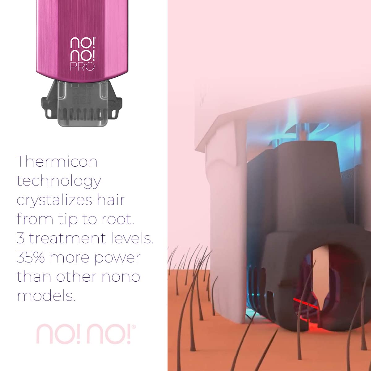 no!no! Pro Hair Removal Device - Treats All Skin Colors and Hair Types - Hair Removal for Women and Men - Hair Remover for Face & Body Hair - Pink