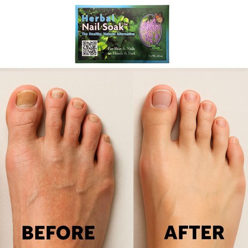 Long Creek Herbs Nail Soak - 100 Percent Natural Hand and Foot Soak - Strengthens Nails and Softens Skin - Relieves Dryness and Cracked Heels