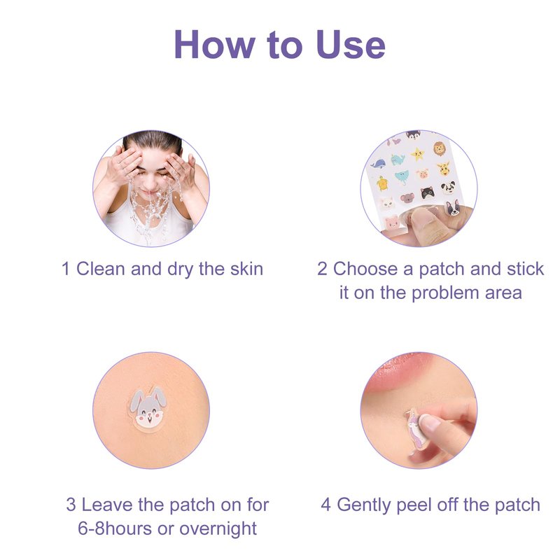 Yorkline Cute Animal Hydrocolloid Pimple Patches, Acne Treatment with Salicylic Acid, Tea Tree Oil, Fast Healing and Gentle on Skin (120 Count)