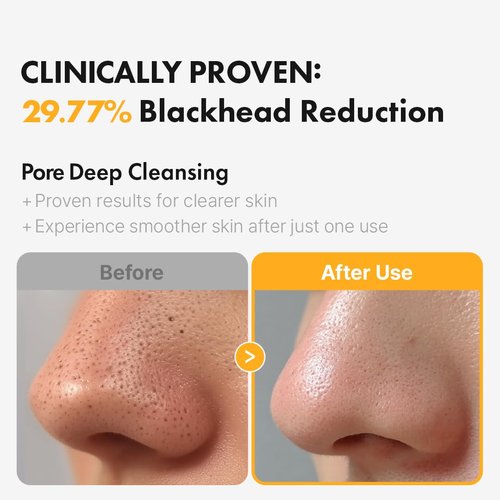 Hanskin PHA Pore Cleansing Oil - Deep Cleansing Makeup Remover for Sensitive Skin | 10.14oz