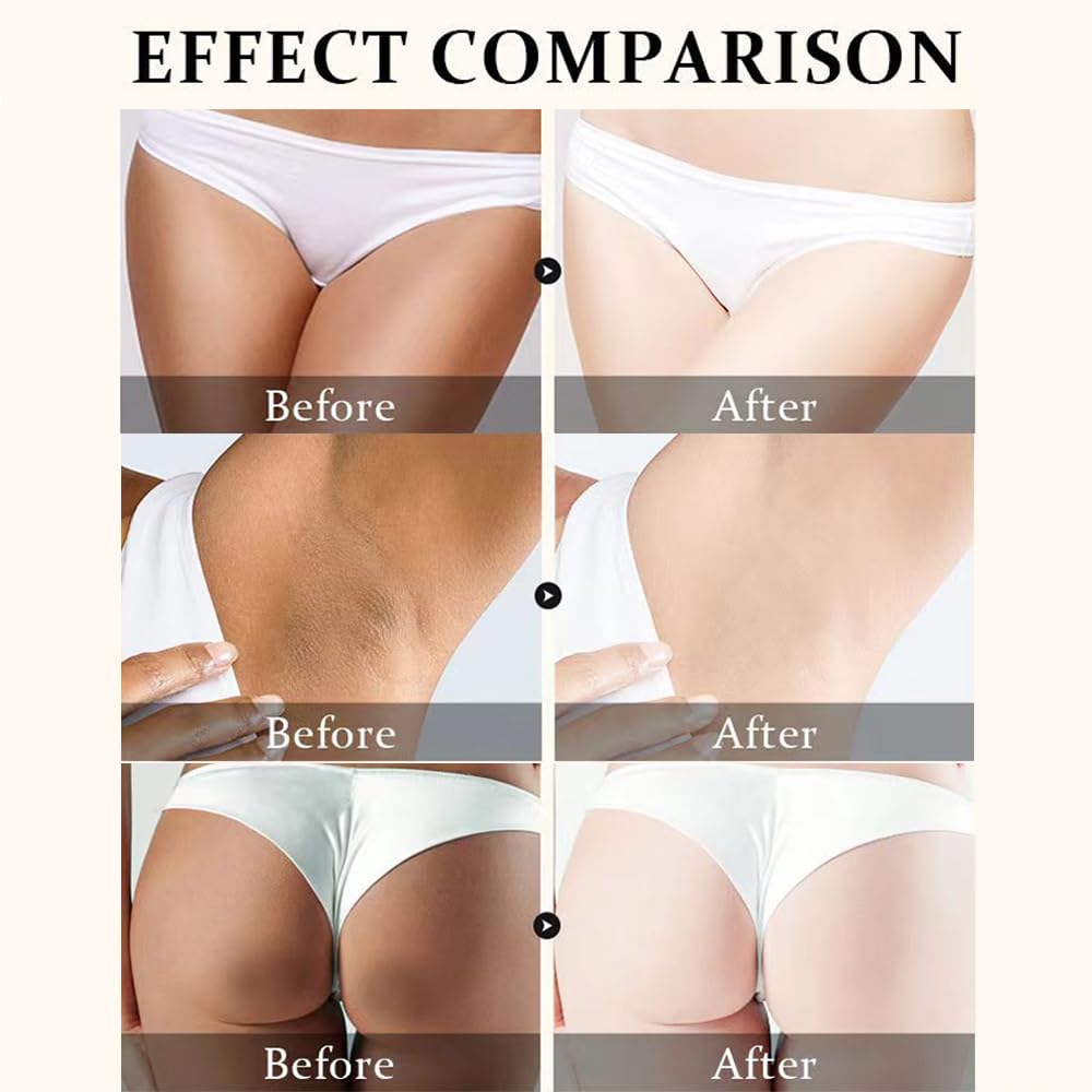 Crema para Aclarar las Axilas y Partes Intimas, Eliminador de Manchas Oscuras para la Cara, Crema Aclaradora para Áreas Íntimas, Cuello, Axilas, Codos, Muslos Internos y Rodillas