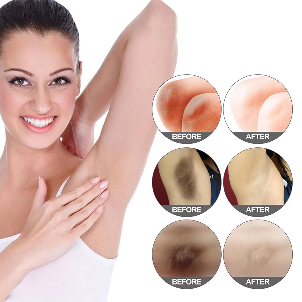 Crema para Aclarar las Axilas y Partes Intimas, Eliminador de Manchas Oscuras para la Cara, Crema Aclaradora para Áreas Íntimas, Cuello, Axilas, Codos, Muslos Internos y Rodillas