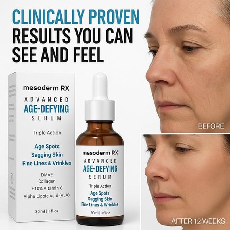 Mesoderm RX Advanced Age-Defying Serum, Triple Action for Age Spots, Sagging Skin, Fine Lines & Wrinkles, 1 fl oz