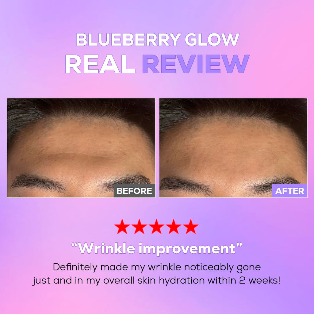 KIKIGLOW Blueberry SOS Intensive Anti-Aging Ampoule 40ml – Korean Firming Facial Ampoule with Vegan Collagen, Hyaluronic Acid, Adenosine, Antioxidant Care, Wrinkle & illuminating