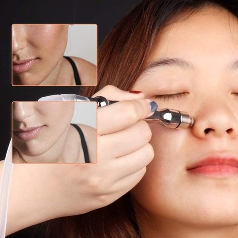 Diamond Dermabrasion Accessories 9 Tips 3 Wands Microdermabrasion Machine Replacements Dermabrasion Tool Professional or Home Use