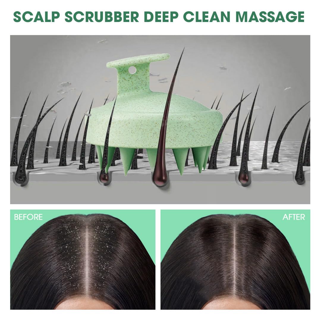 Hotosu Scalp Massager Brush for Hair Growth – Silicone Scalp Scrubber & Scalp Exfoliator – Manual Scalp Massager Brush for Wet or Dry Use – Hair Massager Scalp Shampoo Brush Tool (Green)
