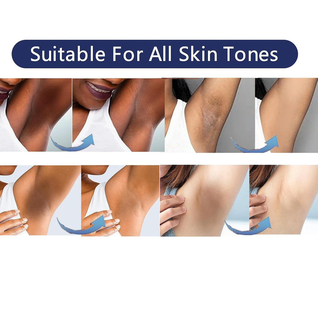 Intimate Areas Skin Lightening Cream Bleaching Cream For Body Sensitive Intimate Area, Private Parts, Underarm, Knees, Elbows, Inner Thigh, Bikini Areas, Bikini Line, Natural Skin Whitening.
