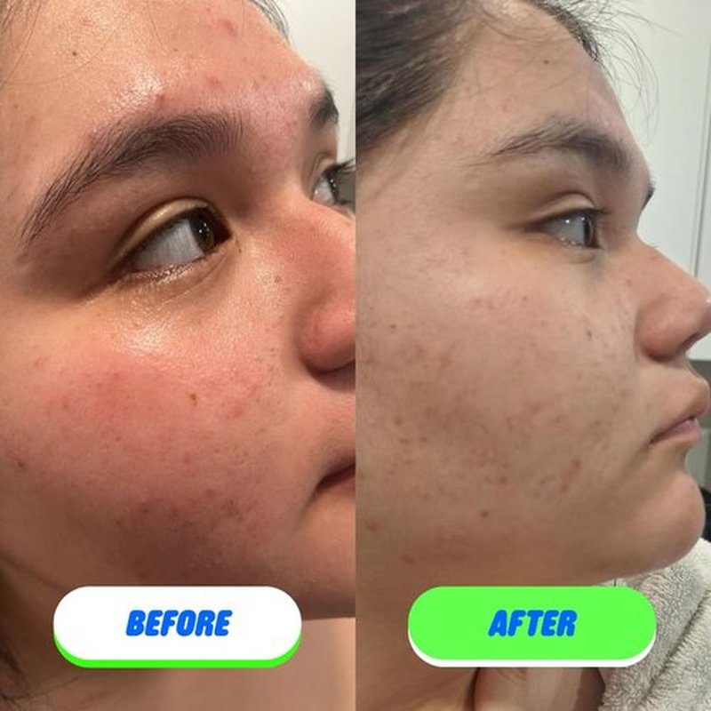 Pipa Skin Saver Hypochlorous Acid Spray for Face & Body 60 ml | Head to Toe Daily First Aid Skin Repair Spray for Sensitive Skin | Helps Reduce Eczema, Irritations, Rashes, Acne, Redness & Breakouts