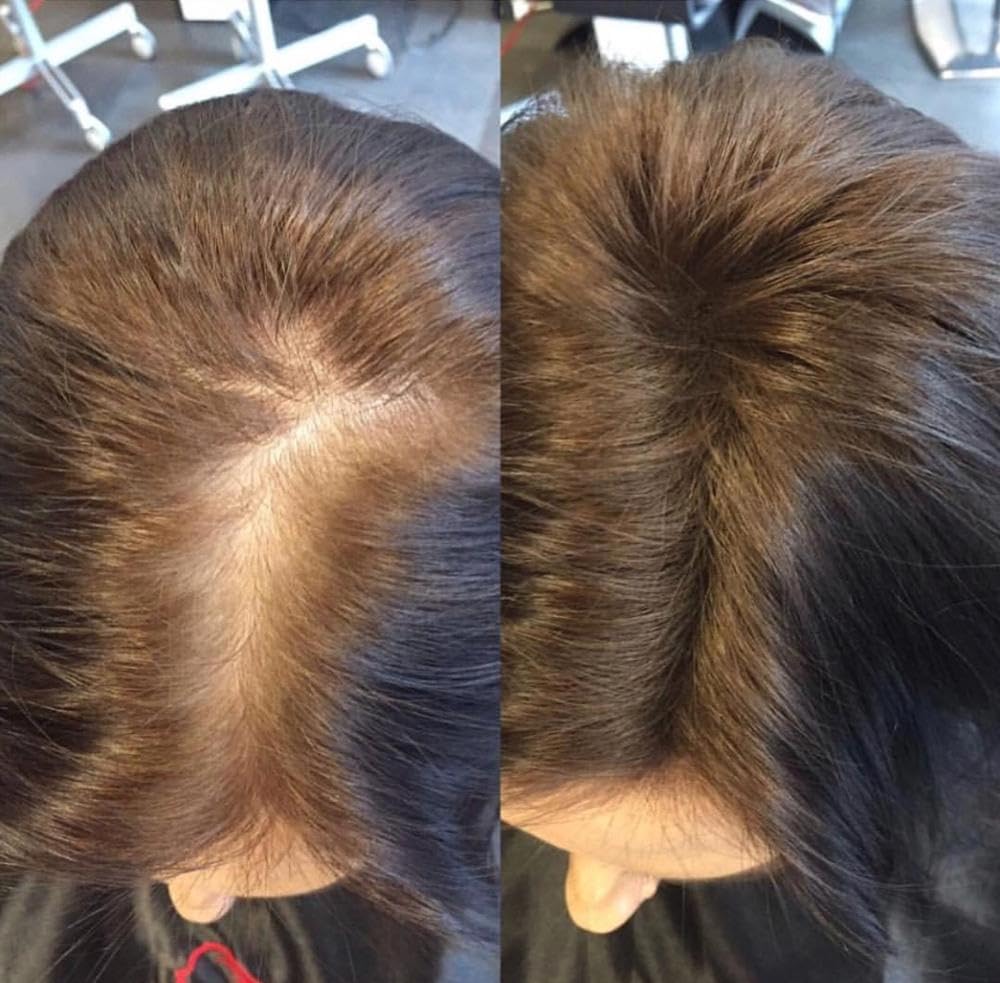 FIBR Hair Keratin Building Fibers, Fill In Fine and Thinning Hair for instant Full and Thick Look, Premium Hair Fibers For Both Men and Women (Blonde)