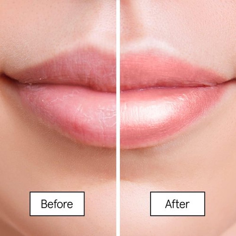 Grace & Stella Lip Butter - Hydrating Lip Balm & Nourishing Mask - Travel Size (1-Pack) for Overnight Repair