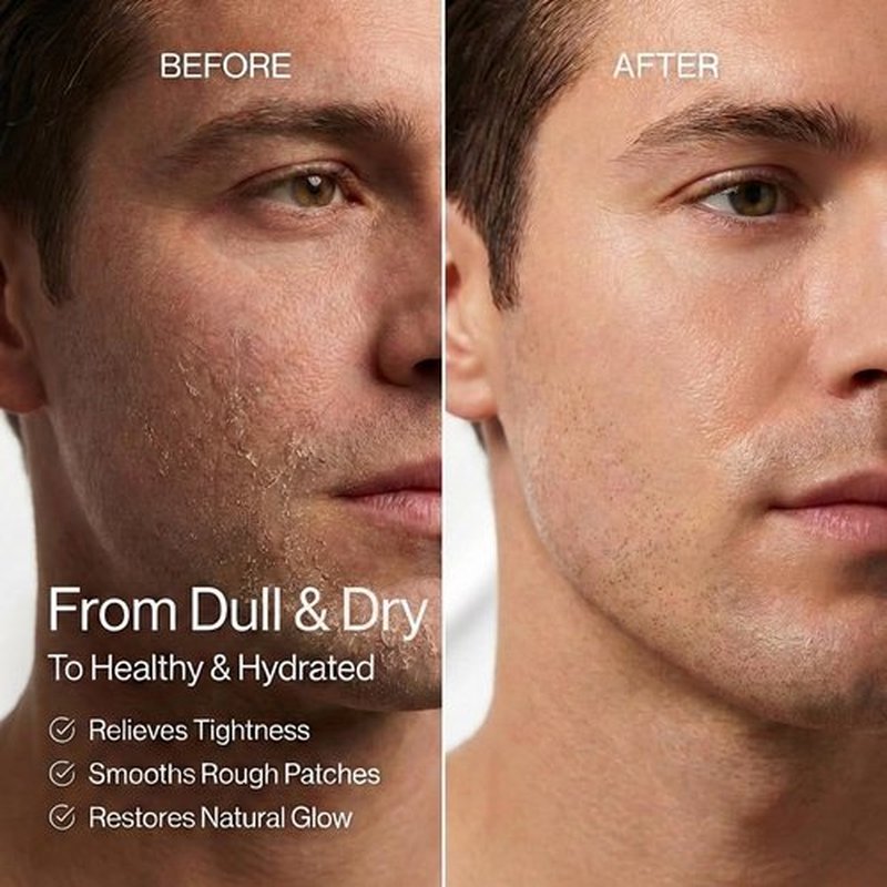 Anthony All-Purpose Facial Moisturizer | Hydrating Lotion for Dry Skin – Lightweight, Non-Comedogenic – 3 Fl Oz