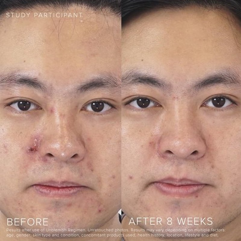 Rodan + Fields UNBLEMISH Invisible Matte Defense SPF 30 - Broad Spectrum Sunscreen for Face & Neck