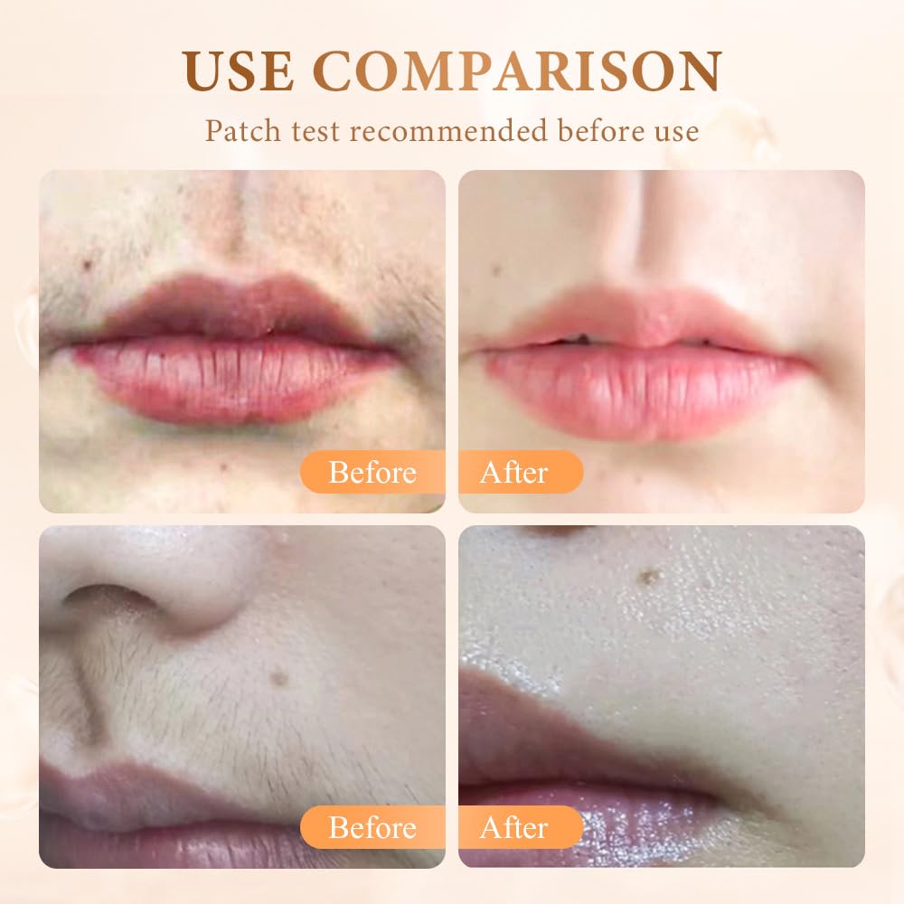 Facial Hair Removal Cream for Women, 2026 New Gentle Face Facial Hair Removal Cream for Women, Effective Hairs Removers for Face Hairs Removing (1, 0.71oz / 20 g)