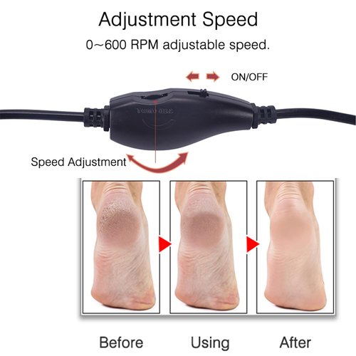 Electric Foot Callus Remover,LXIANGN Electronic Foot File Grinder with Speed Adjustable and 60pcs Replacement Sandpaper Discs,Pedicure Foot File Sander for Men Women Dead Cracked Hard Skin Calluses