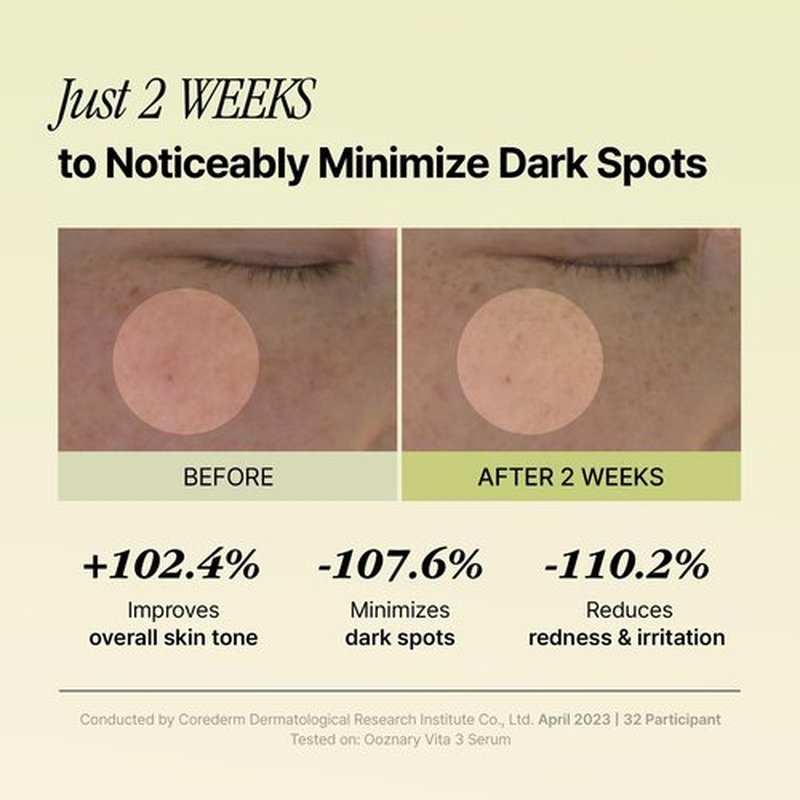 Ooznary Vita 3 Serum with Vitamin C Derivatives and Niacinamide plus Glutathione for Uneven Skin Tone & Dull Skin | Korean Skin care | 1.69 fl.oz 50ml