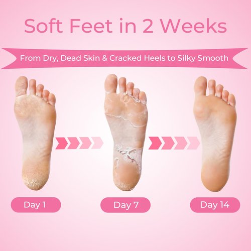 SAISZE Foot Peeling Mask, 4 Pairs Foot Peel Mask for Dry Cracked Feet, Dead Skin Callus Removal, Repair Soft Feet