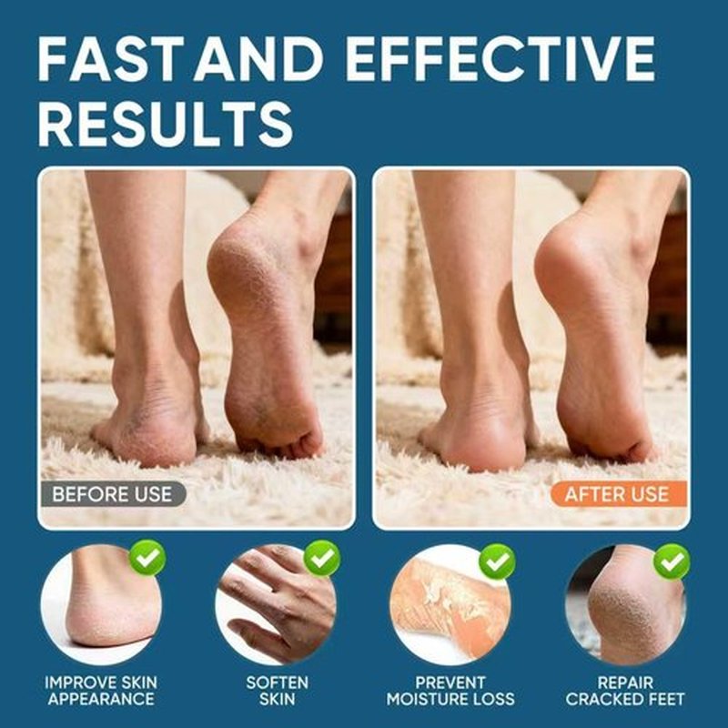 Regine Switzerland Urea Cream 60% with Salicylic Acid 2% - Maximum Strength Foot Cream for Dry, Cracked Heels