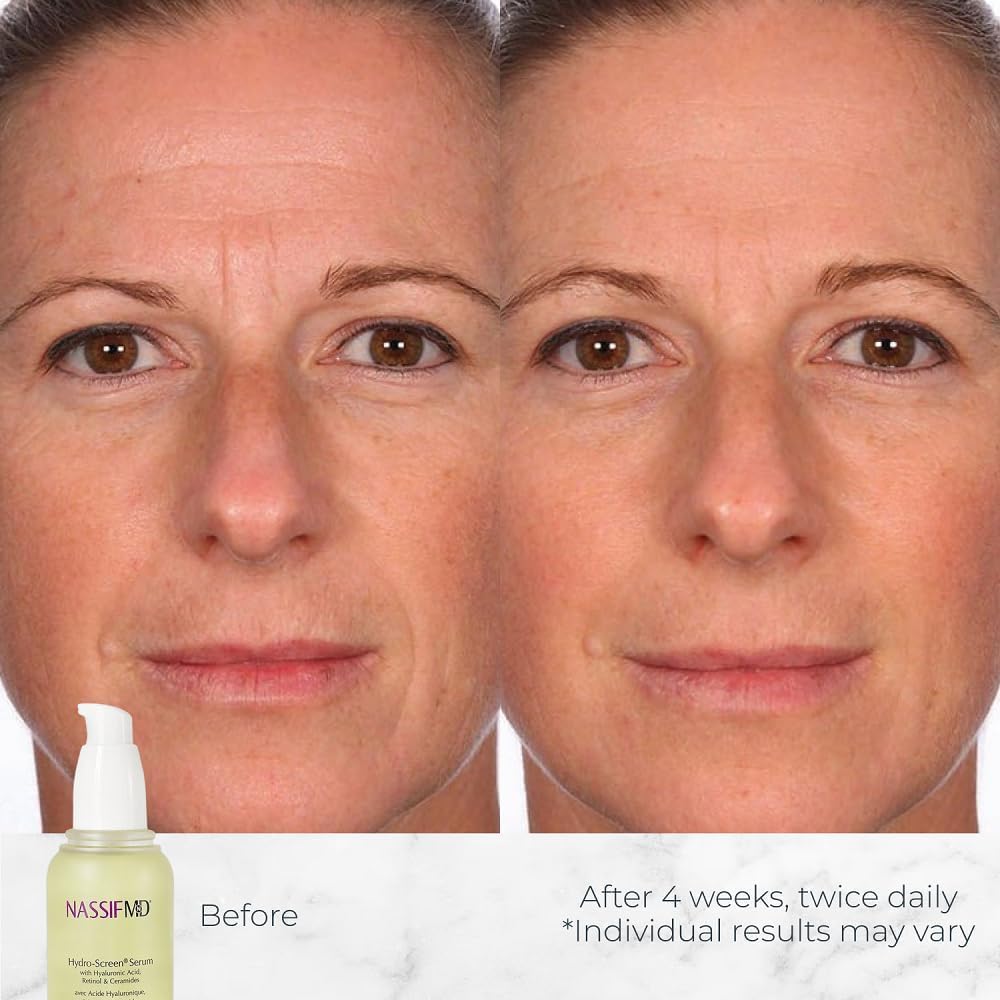 NassifMD Hydro-Screen Serum