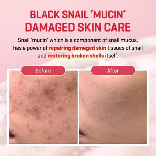 SOME BY MI Snail Truecica Miracle Repair Low pH Gel Cleanser - 3.38Oz, 100ml - Made from Snail Mucin for Sensitive Skin - Daily Face Wash for Deep Cleansing and Skin Moisturizing - Korean Skin Care