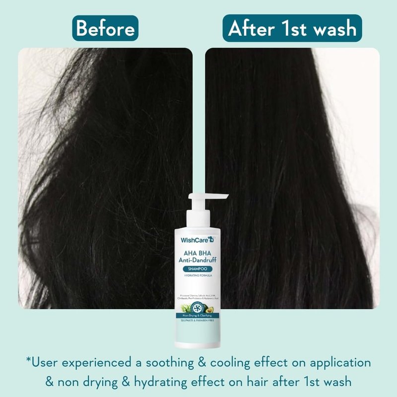WishCare Hydrating AHA BHA Anti Dandruff Shampoo For Women & Men-Paraben & Sulphate Free Shampoo 250ml
