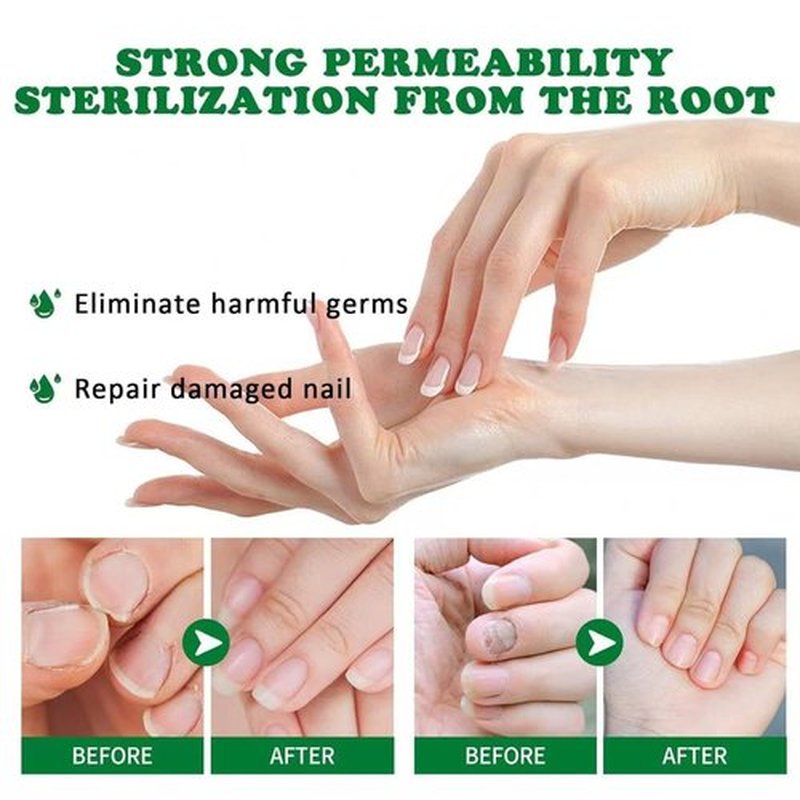 2PCS Nail Repair Gel, Nail Growth Repair Cream, Multi-Purpose Nail Repair