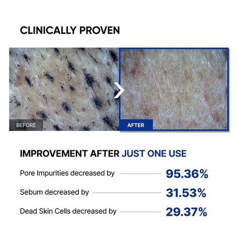 SAYNID Microbiome Renewing Cream Mask, Wash-off Face Mask, Cream Exfoliating, Pore Care, Glass Skin Effect, Barrier-Friendly Korean Skincare | 3.38 fl.oz. (100ml)