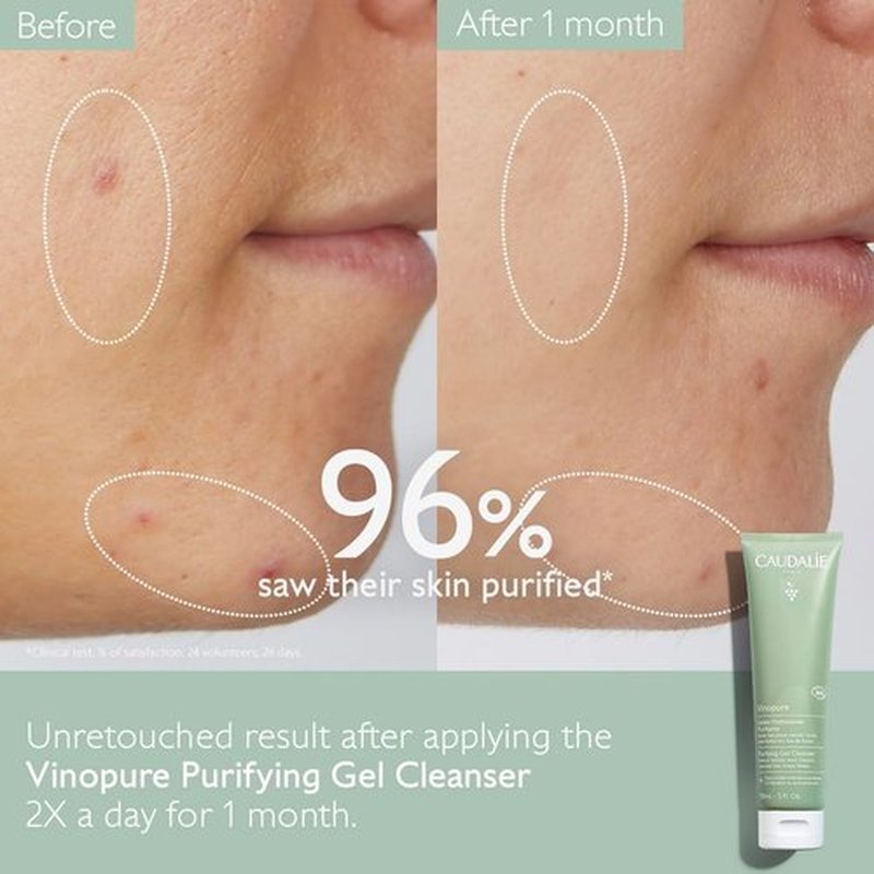 Caudalie Vinopure Salicylic Acid Cleanser - Pore Purifying Gel Formula | 150 mL