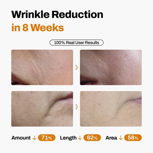 JEU'DEMEURE DermiShuttle Lifting Kit - Anti-Aging Face Serum for Firming & Hydration with Collagen | 8-Week Treatment